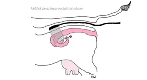 Field of view linear rectal transducer 1