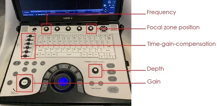 Ultrasonography: equipment and preparation